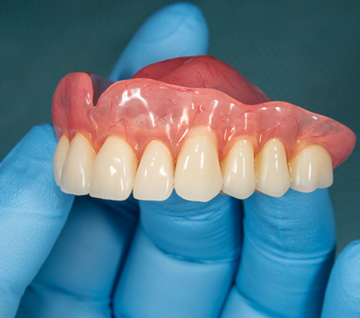 Gloved hand holding a full upper denture