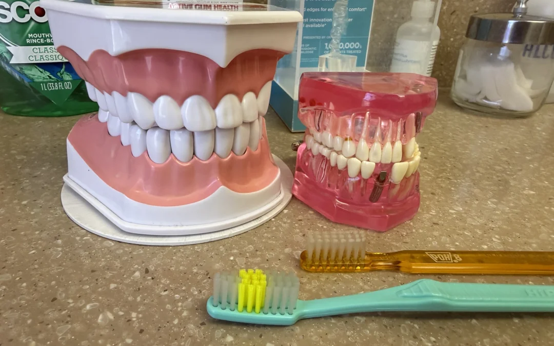 Can You Kiss With Dentures?
